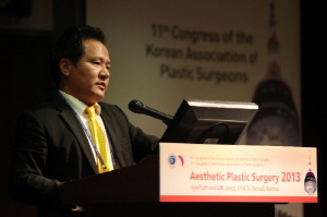 코끝교정술, 구축으로 변한 들창코를 해결한다