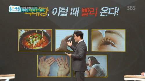 '좋은아침’ 겨울철 실명을 부르는 안질환, 충분히 예방 가능해