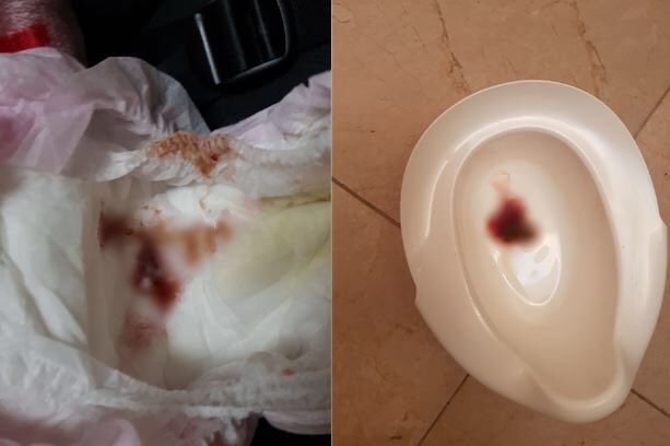 피해자 측은 B(2)양이 지난 5월 맥도날드 햄버거 패티 등이 포함된 맥모닝세트를 먹고 혈변 증세를 보였다고 주장했다. 황다연 법무법인 혜 변호사 제공