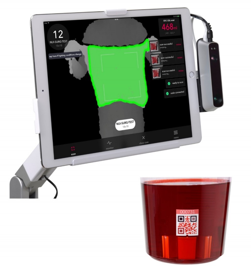 △가우스서지컬의 트라이톤 제품 이미지./사진=가우스서지컬