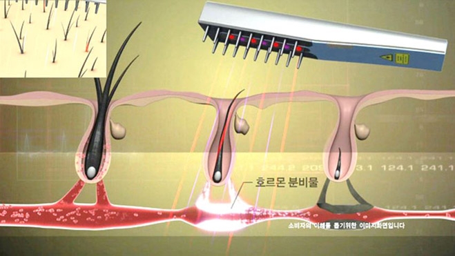 판시딜 효과, 더 보기원한다면 ‘닥터나인 헤어세이버’