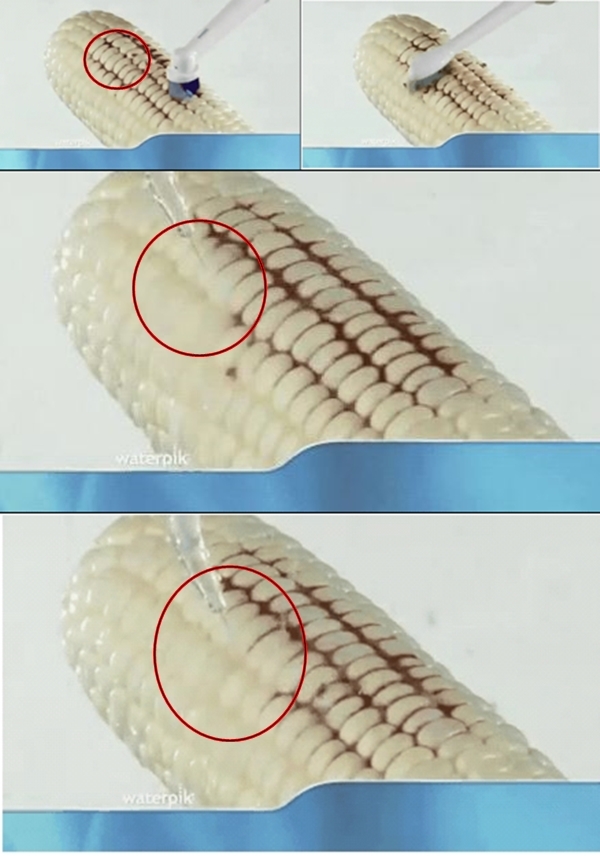 워터픽 (사진: 웹 커뮤니티)