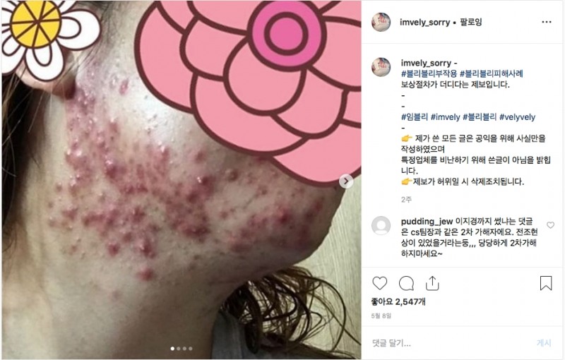 A씨는 지난달 초 'imvely_sorry'로 활동하는 SNS 계정 운영자에게 피부 증상을 호소하는 제보를 했다. /사진=인스타그램 'imvely_sorry' 계정 갈무리