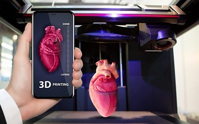 "의료산업 3D 프린팅 재료 시장, 2025년까지 매년 20%씩 성장"