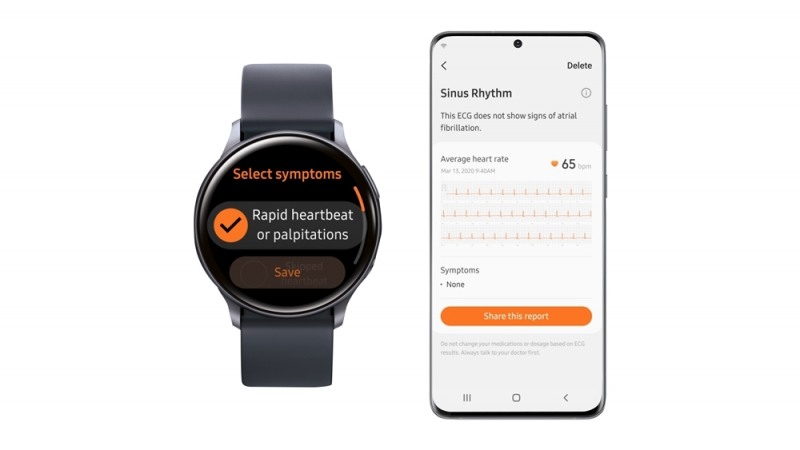 삼성전자가 식품의약품안전처로부터 심전도(ECG) 측정 앱 허가를 받았다. 삼성 헬스 모니터 앱과 갤럭시 워치 액티브2를 통해 심전도를 측정, 확인할 수 있다./사진=삼성전자