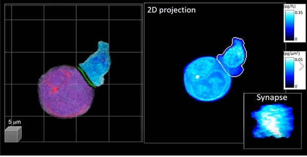 개발된 기술이 적용된 3D 영상. (좌측: 인공지능으로 분석된 3D 비표지 홀로그래피 영상. 보라색 – 타겟 암 세포, 파란색 – CAR-T 세포, 우측: 2차원 누적 영상. 우측 하단: 추출된 IS 영상 정보). (사진=KAIST 제공)