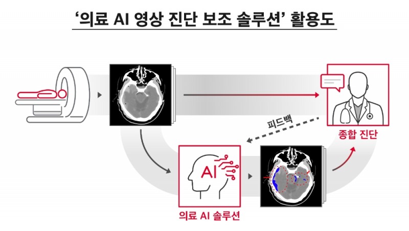 의료 AI 영상 진단 보조 솔루션 활용도. 이미지=SK텔레콤