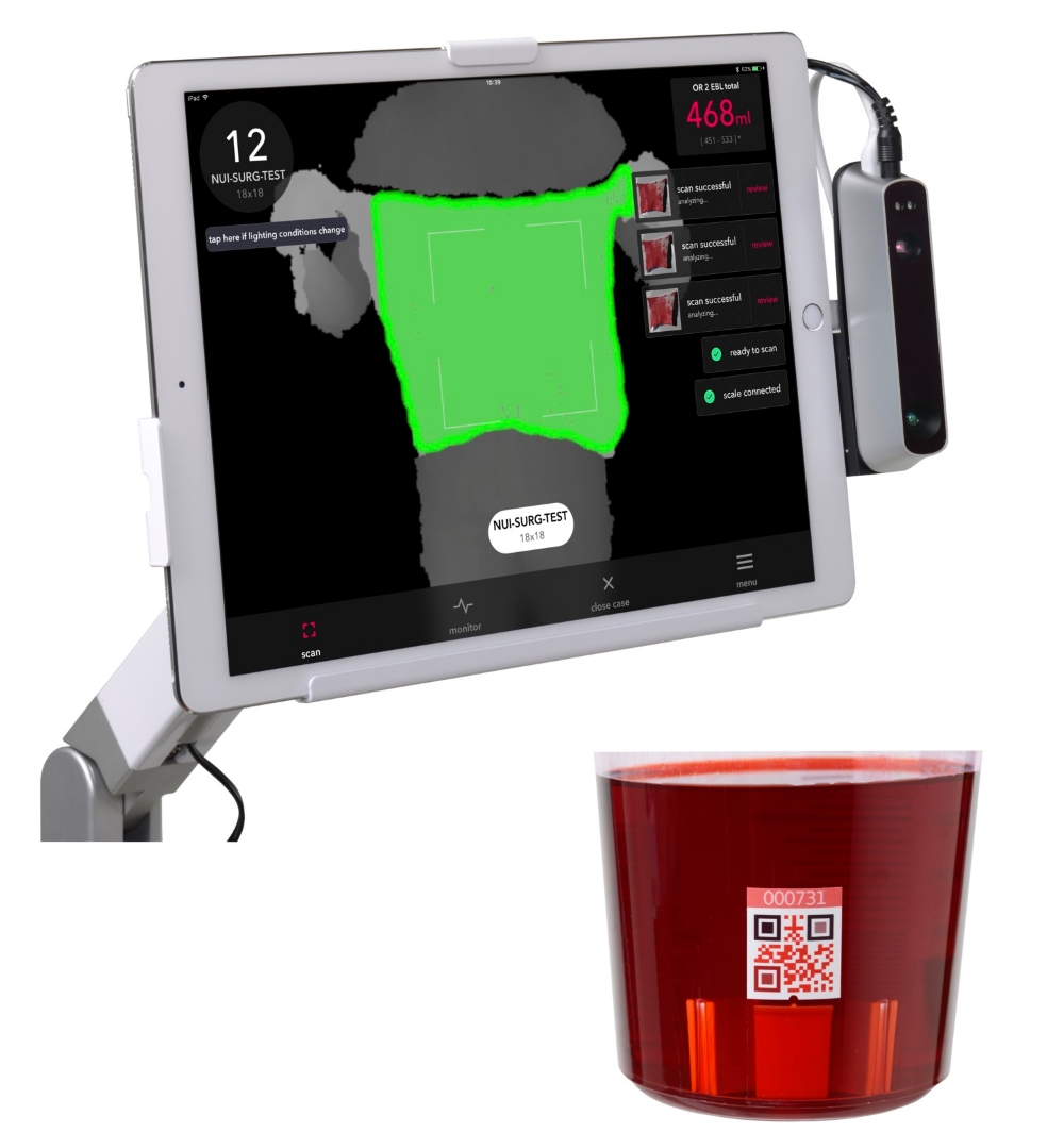 △가우스서지컬의 트라이톤 제품 이미지./사진=가우스서지컬