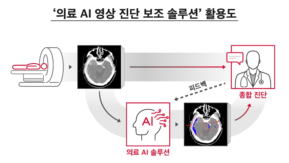 의료 AI 영상 진단 보조 솔루션 활용도. 이미지=SK텔레콤