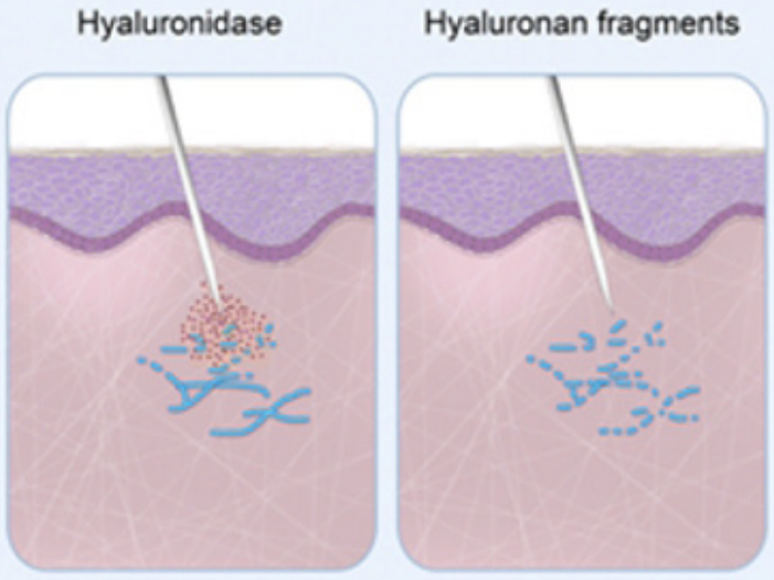 ALT-B4 작용기전. /사진=알테오젠
