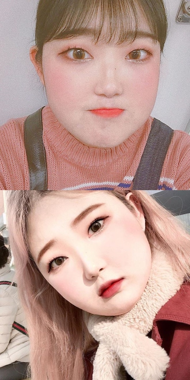 루푸스병 최준희 (사진: 최준희 SNS)