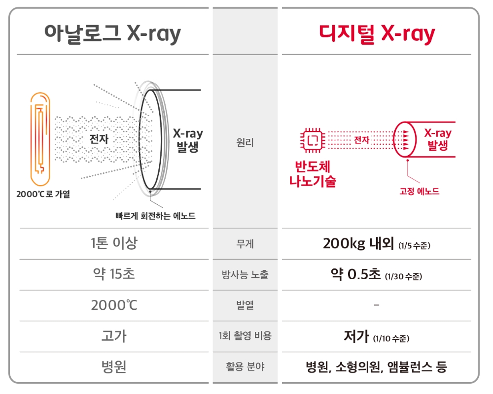 아날로그 X-ray와 디지털 X-ray 비교/사진=SK텔레콤